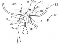 An image from the granted Lexmark patent